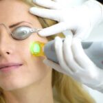 Αποτρίχωση Laser σε Πρόσωπο 2