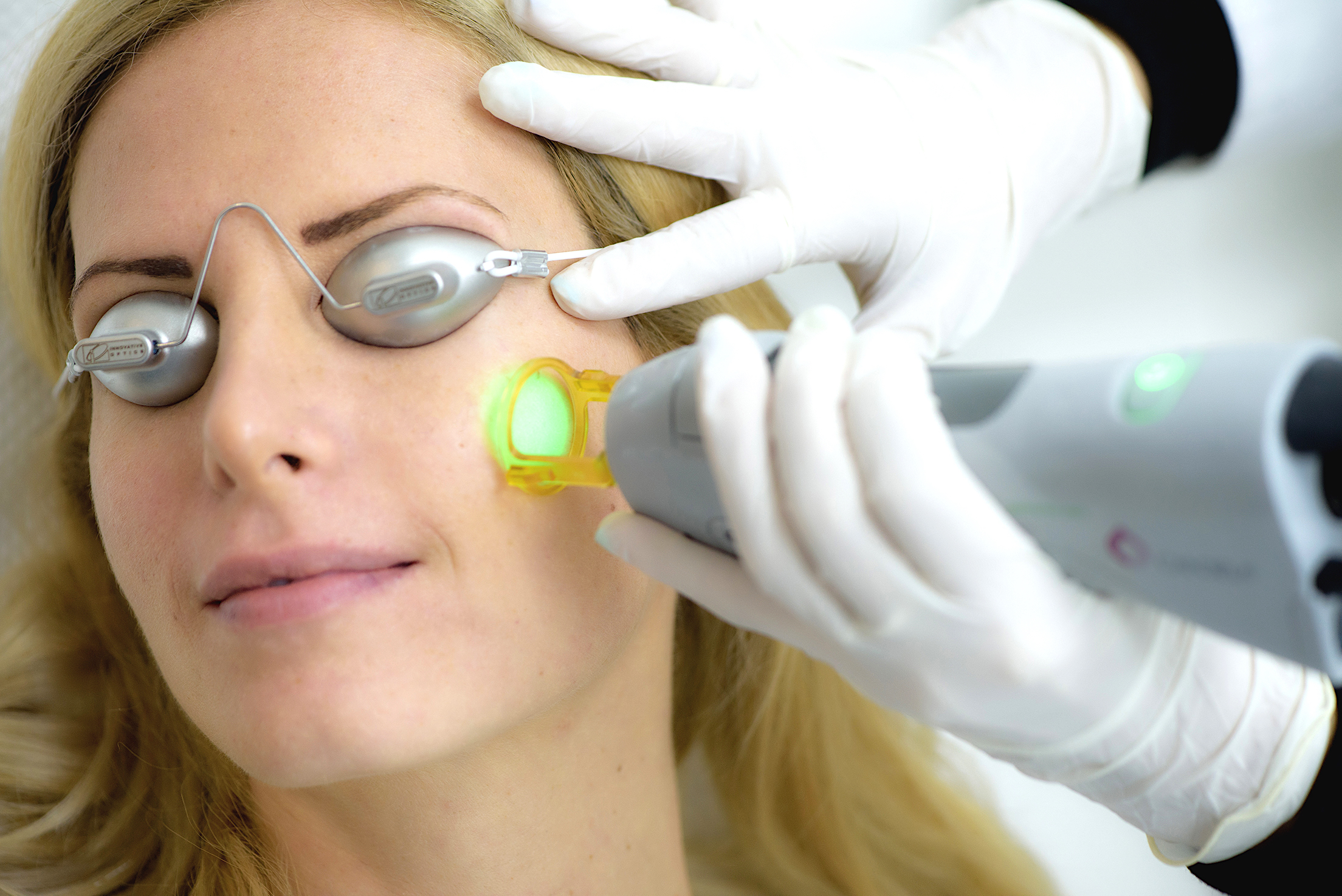 Ποια εποχή πρέπει να κάνω αποτρίχωση με laser;