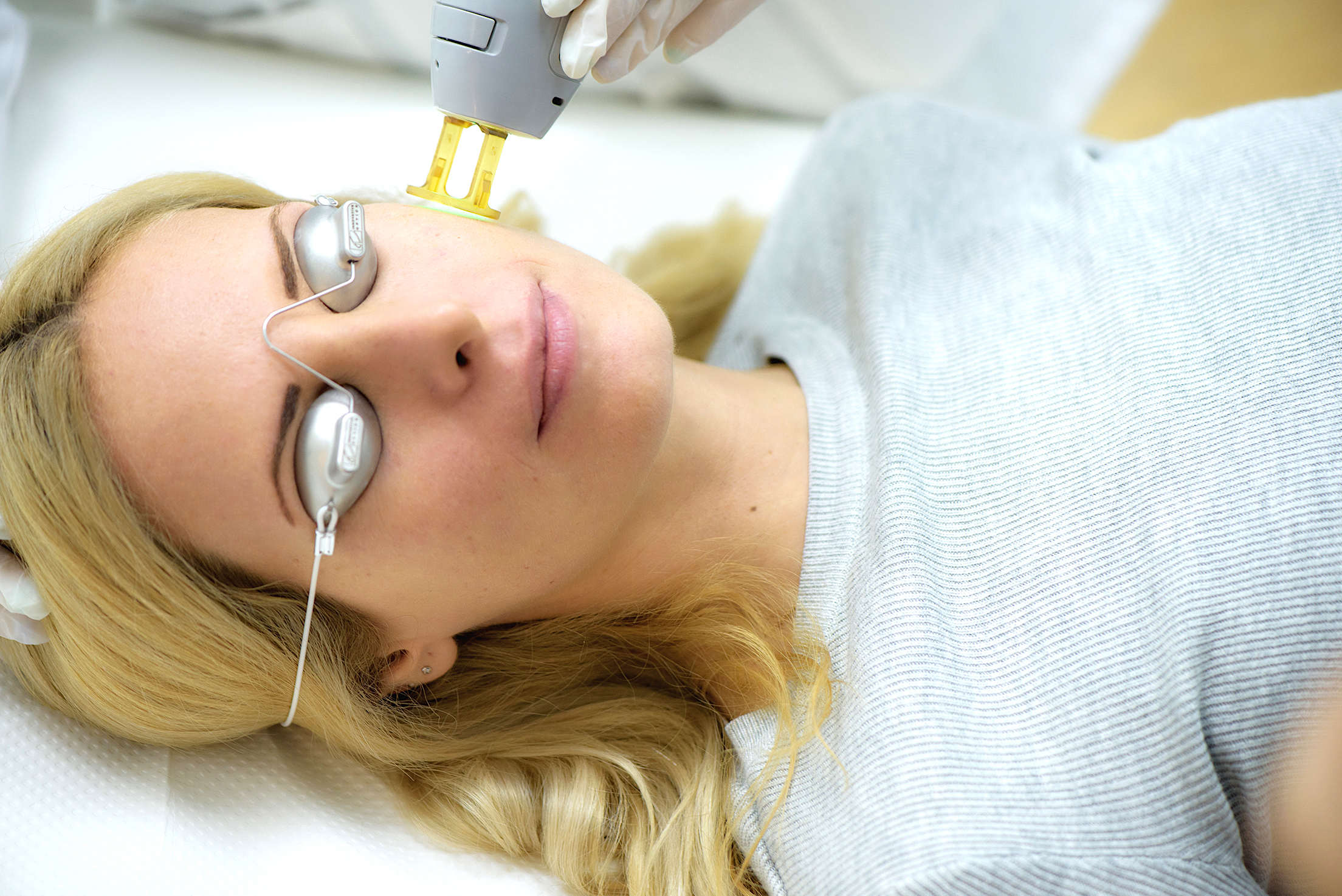 Τι να προσέξετε πριν την αποτρίχωση με laser – Πλήρης οδηγός