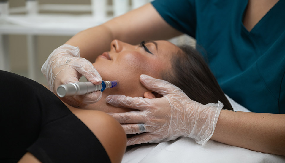 Dermapen-(3)