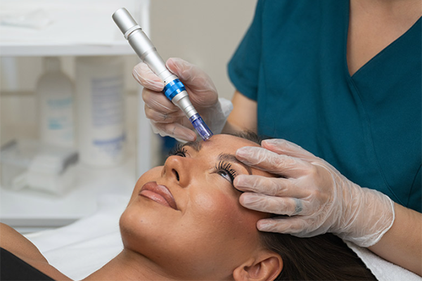 dermapen
